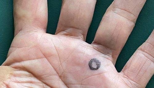 醫書（問道中醫）指出常按揉無名指根可拒絕病毒